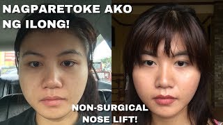 NON SURGICAL NOSE LIFT USING THREADS! RETOKADA!