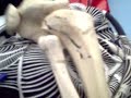 MOV0162A.3gp knee joint جامعة ذمار