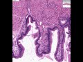 Title:Shotgun Histology Gall Bladder Description:Shotgun Histology Gall Bladder