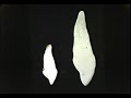 Dental Anatomy: Primary Dentition