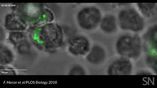 Watch neutrophils kill Trichomonas vaginalis | Science News
