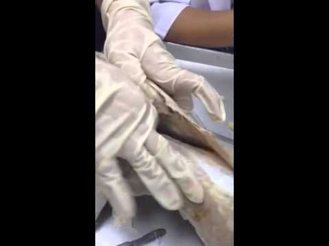 Cat Muscles Dissection - Dorsal side (part 2) - YouTube