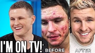 My Acne Story On National TV! (THE DOCTORS - OFFICIAL VIDEO) My Acne Story On National TV! (THE DOCTORS - OFFICIAL VIDEO)