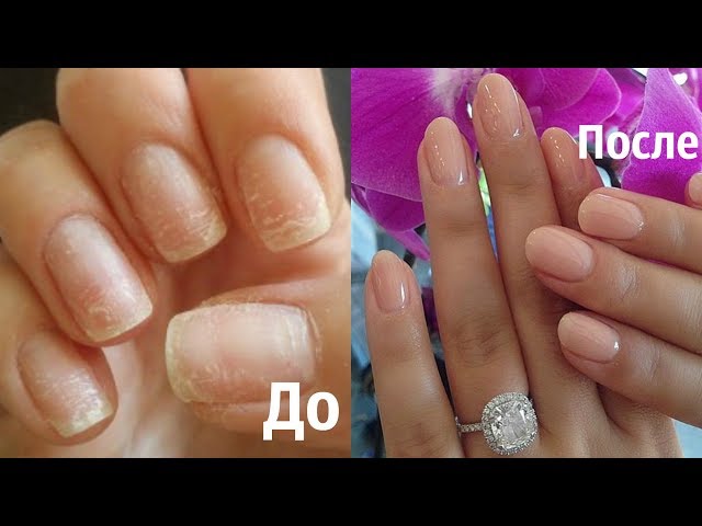 Чем лечить ногти после гель лака в домашних условиях 293 Чем лечить ногти после гель лака в домашних условиях 699