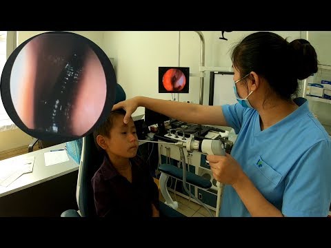 Kinh Dị Cảnh Bắt Con Đỉa Sống Trong Mũi Cậu Bé H'mông A Cai | Trình Tường TV