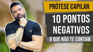 10 PONTOS NEGATIVOS DE USAR PRÓTESE CAPILAR | Você precisa saber disso!