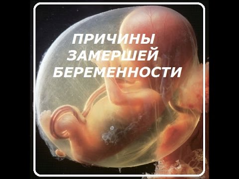 Беременность на ощуп: ru_perinatal Беликова Мадина Евгеньевна, гинеколог, Санкт-Петербург