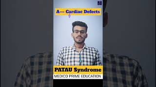 Patau Syndrome Symptoms Memonics Of Patau Syndrome
