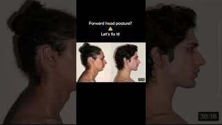 Forward Head Posture? Lets Fix It
