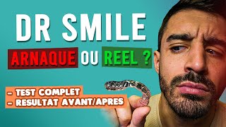 Mon Avis Sur Dr Smile 2025 Test, Conseils Essentiels Et Resultat Avantaprès