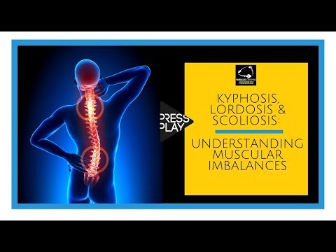 Kyphosis, Lordosis and Scoliosis: Understanding muscular imbalances