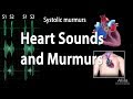 Heart Sounds and Heart Murmurs, Animation.