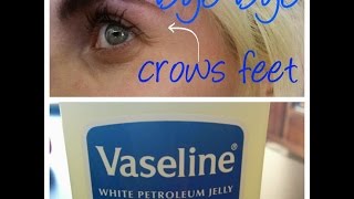 How To Avoid Crows Feet Eyes Emily Anderson