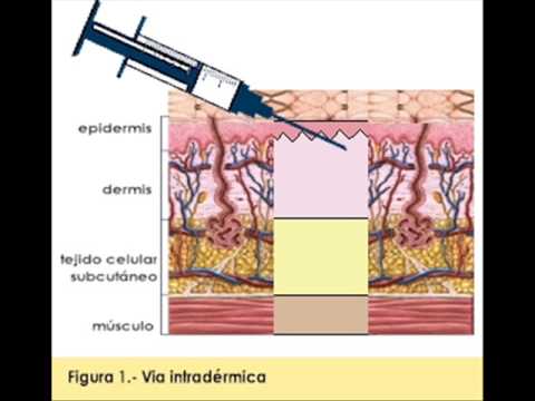 Proyecto vacunas : Vias de administracion - YouTube Proyecto vacunas : Vias de administracion - YouTube