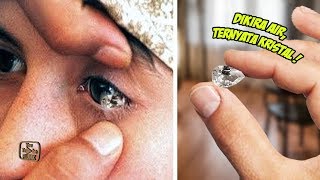 Sulit Dipercaya! Awalnya Dikira Air Mata Biasa, Ternyata ...