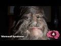 5 Most Bizarre Diseases