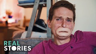 The Extraordinary Case of Alex Lewis ( Documentary) | Real Stories