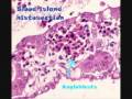 angiogenesis - types of angiogenesis angiogenesis - types of angiogenesis