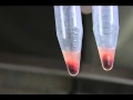 Watch Stem Cell procedure curing pets of pain Video