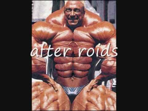 Bodybuilders after steroid use