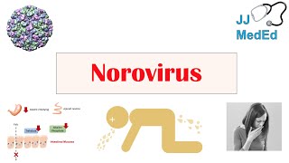 Norovirus (Norwalk Virus) | Transmission, Pathogenesis, Symptoms, Prevention