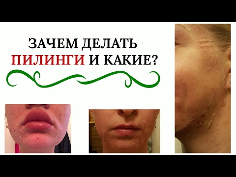 Зачем делать пилинг Зачем делать пилинг