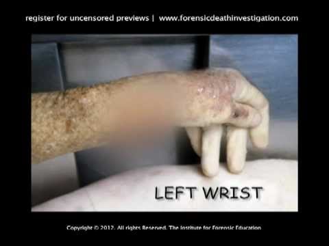 Motor Vehicle Deaths — CSI/Autopsy Training Promo *censored* - YouTube