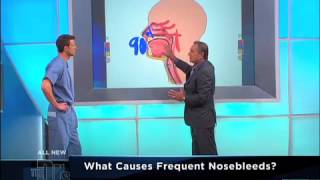 Recurring Nosebleeds Medical Course