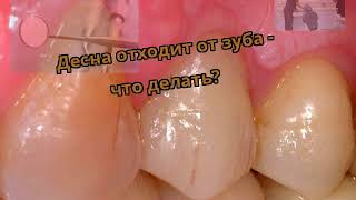 Оголившиеся шейки зубов народными средствами Оголившиеся шейки зубов народными средствами