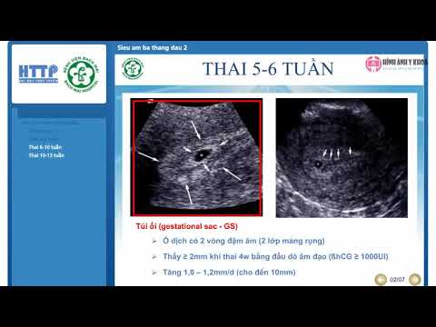 18. Siêu âm thai ba tháng đầu - ThS.BSCKII Vũ Công Khanh (SIÊU ÂM TỔNG QUÁT BỆNH VIỆN BẠCH MAI)