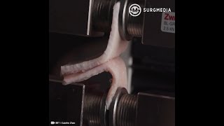 Double-Sided Tape Could Replace Surgical Sutures According To A Nature Paper