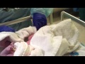 Birth of my son by C Section Cesarean Baby Delivery Full HD