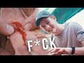 DIEP GAT IN MIJN HAND! (wat Moet Ik Doen??)| Boazvb DIEP GAT IN MIJN HAND! (wat Moet Ik Doen??)| Boazvb