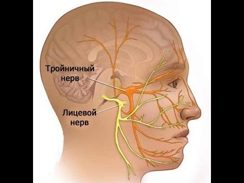 Лечение лицевого тройничного нерва в домашних условиях 685
