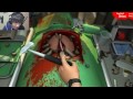 OPERAZIONE IN AMBULANZA! SPETTACOLO!! - Surgeon Simulator 2013 - Parte 4