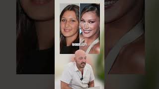Bella Hadid Before & After