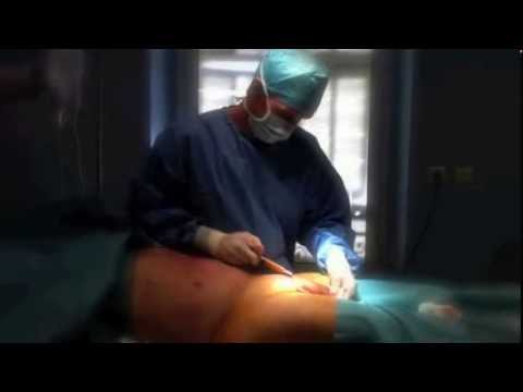 allargamento pene pdf allargamento pene pdf