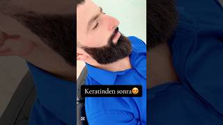 Saqqal Keratini Endirimde