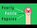 Pearly Penile Papules (PPP) 10 Facts about Pearly Penile Papules