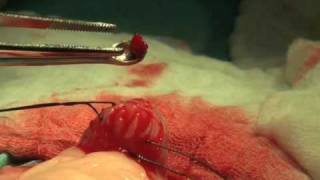 bladder stones surgery cost cat kidney stones surgery costs how to pass a kidney bladder stones surgery cost cat kidney stones surgery costs how to pass a kidney