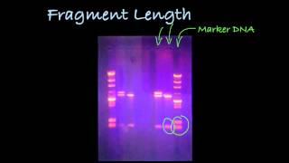 Determining Dna Fragment Length In A Gel