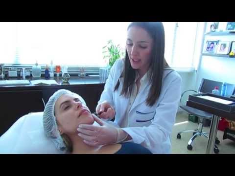 Microdermoabrasión - Dra. Pilar Ochoa