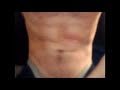 What Stomach Growls Look and Sound Like Inside a Fit, Healthy Body