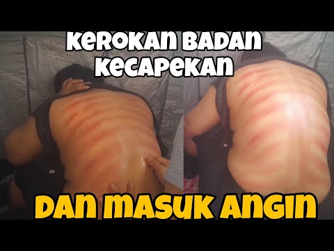 BODY MASSAGE PART 7||BACK SCRAPE FOR TIREDNESS AND COLDS‼️