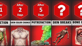 Timelinestages Of Decomposition Human Body After Death ?