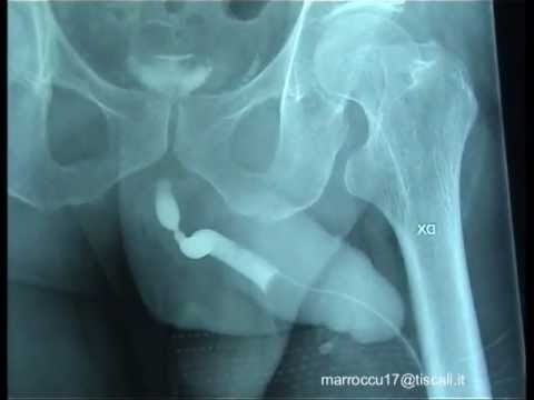 Coscienza a dipendenza alcolica