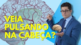Veia Pulsando Na Cabeça. Aneurisma Ou Trombose? Importante Dr. Tontura