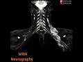 MR neurography (MRN) of the brachial plexus
