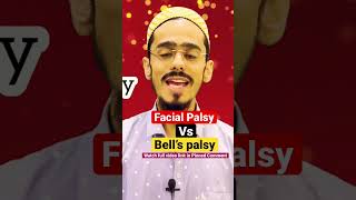 Facial Palsy Vs Bells Palsy