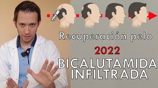 Recuperación pelo 2022 (NOVEDAD): bicalutamida infiltrada